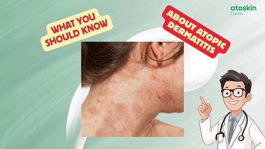 Doctor explaining what you should know about atopic dermatitis with an image of eczema on the neck and shoulder.
