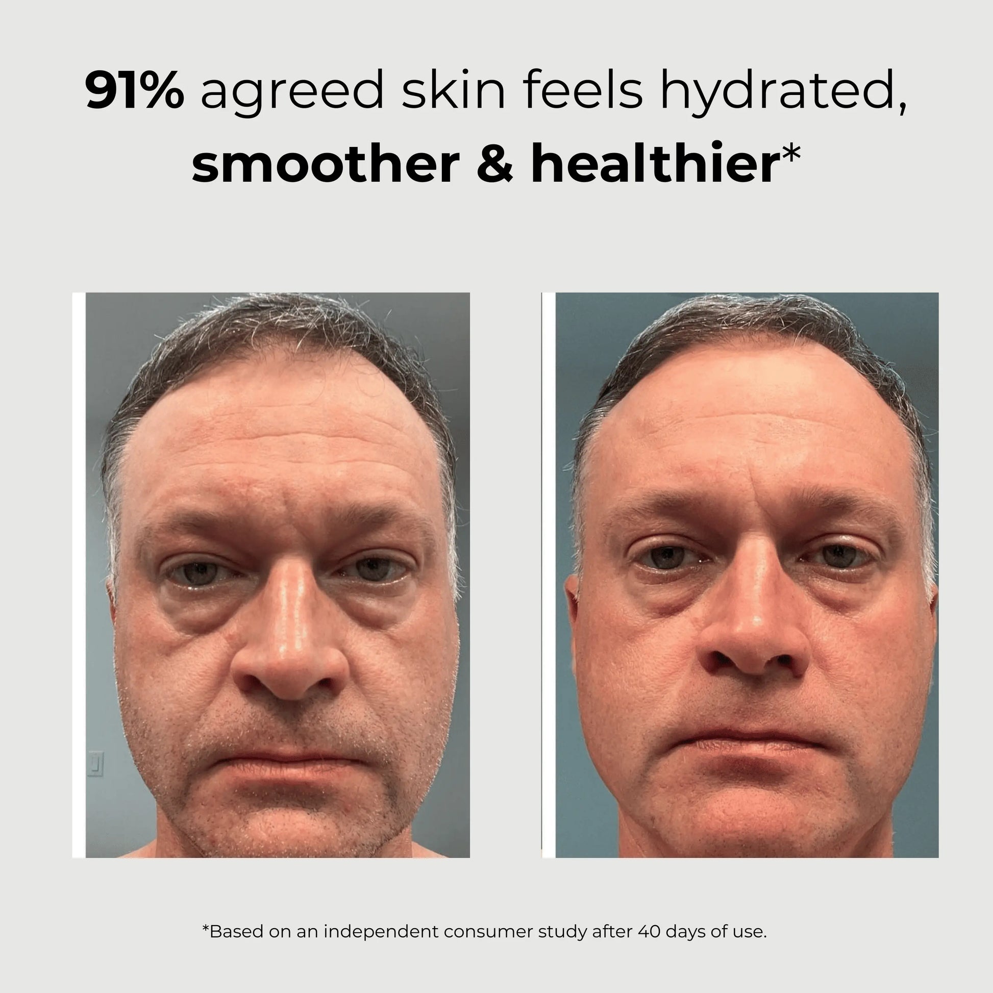 ABERA Men Retinol Serum