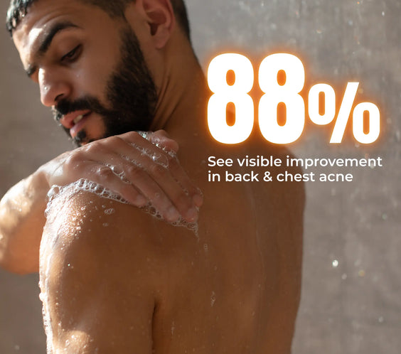 Acne Body Wash For Men