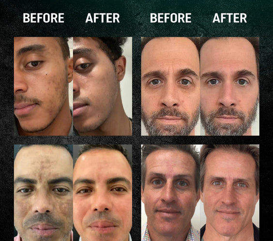 Men Retinol Serum - New Version