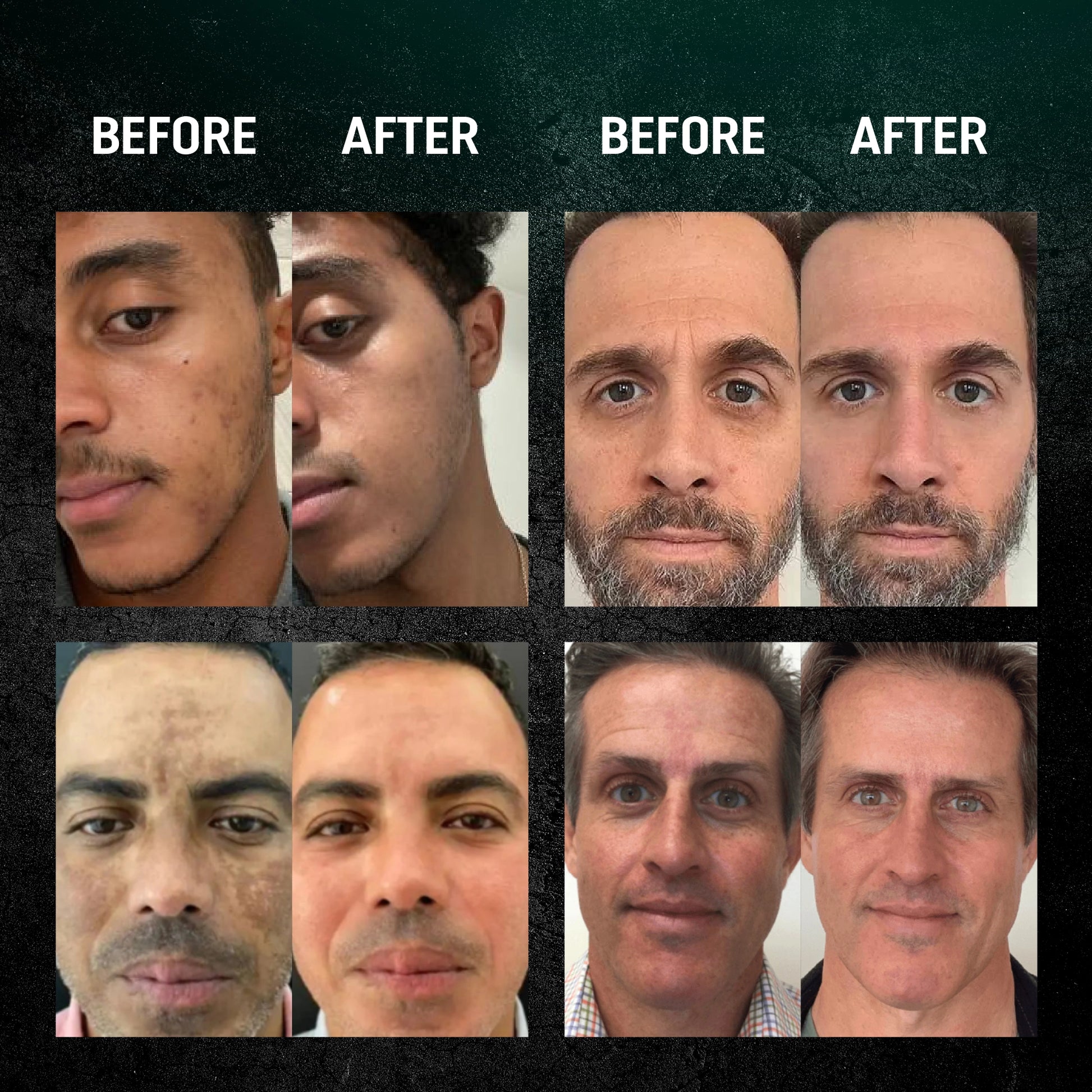 Men Retinol Serum - New Version