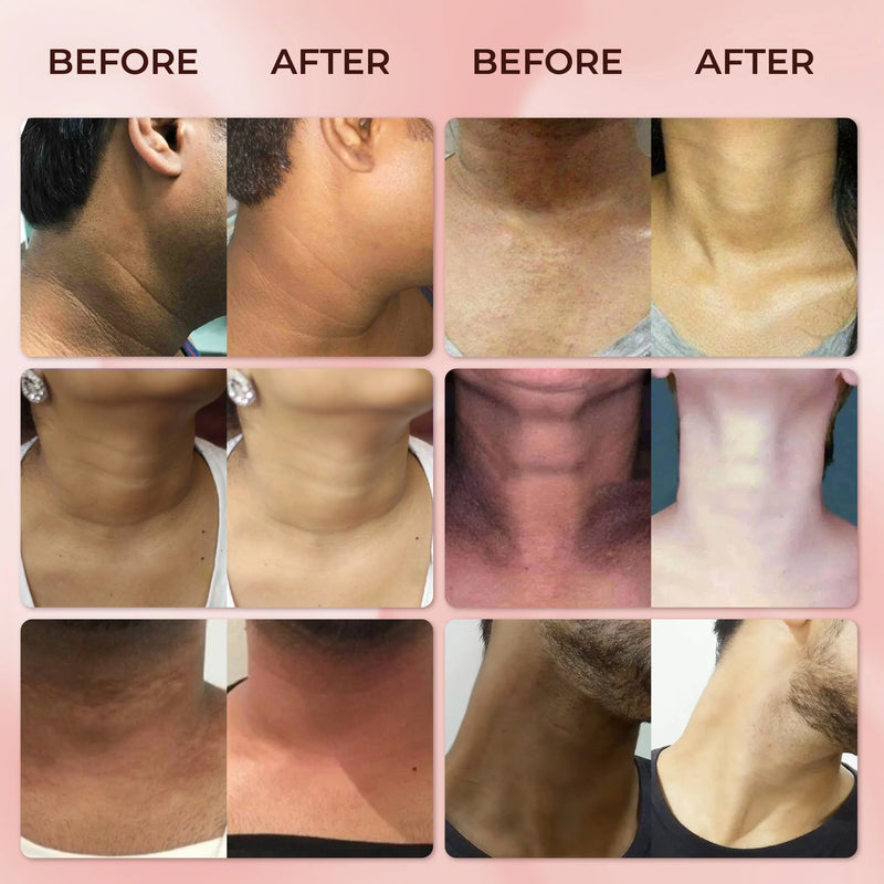 Crema de Colágeno para Cuello ABERA
