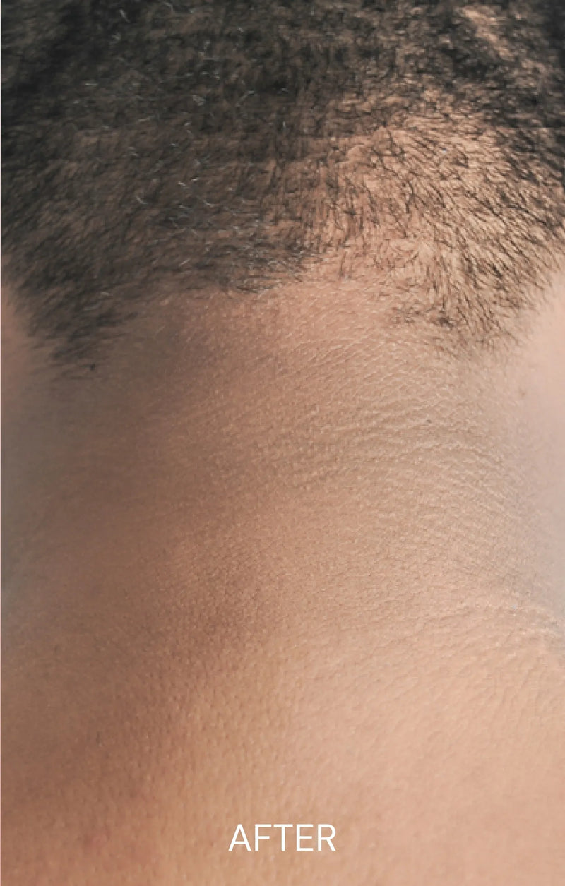 After — Dark Neck